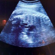 Alphabet - galeria zdjęć - filmweb