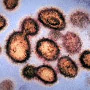 Coronavirus, Explained - galeria zdjęć - filmweb