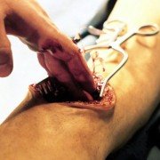 Anatomie 2 - galeria zdjęć - filmweb