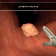 Revenge of the Colon - galeria zdjęć - filmweb