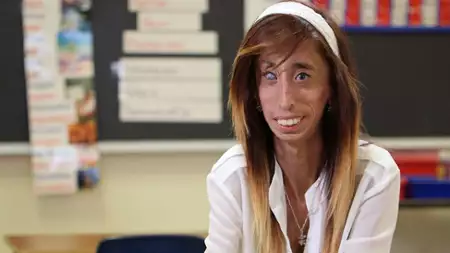 Waleczne serce: Lizzie Velasquez - galeria zdjęć - filmweb