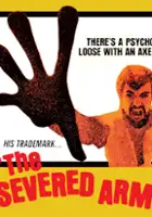 Gary Adelman / The Severed Arm