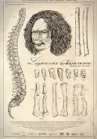 plakat filmu Luzonensis osteoporosis