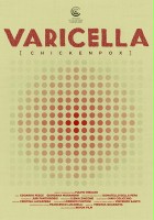 Varicella