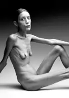 Oliviero Toscani / Anorexia. Storia di un'immagine