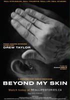 plakat filmu Beyond My Skin
