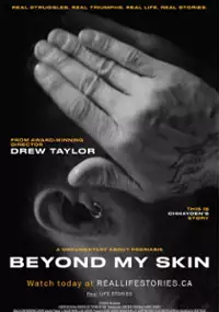 Plakat filmu Beyond My Skin