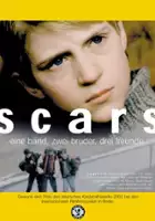 Lasse Kolsrud / Blizny