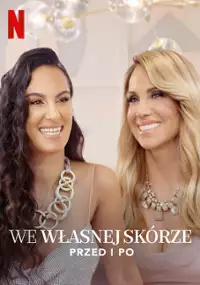 Plakat programu TV We własnej skórze: Przed i po