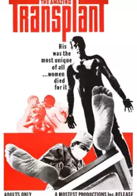 Plakat filmu Niesamowity przeszczep