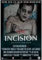 Frank Forbes / The Incision