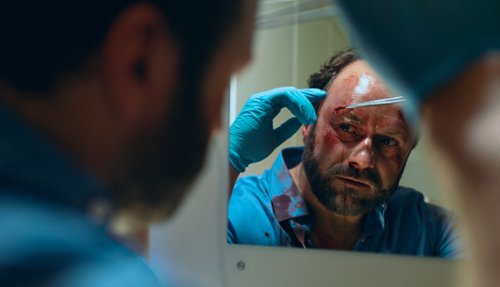 Netflix też ma sw&oacute;j serial medyczny. Zwiastun "Znieczulenia"