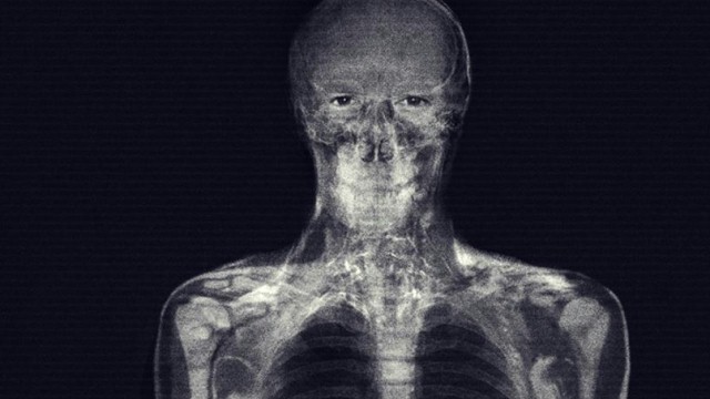 SPOILER? Zdjęcia rentgenowskie bohaterów filmu "Obcy: Przymierze"