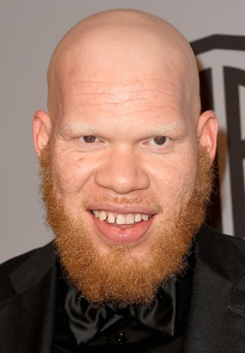 Marvin Jones III / Tobias Whale
