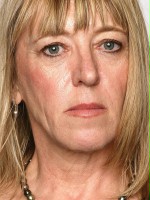 Jody Williams